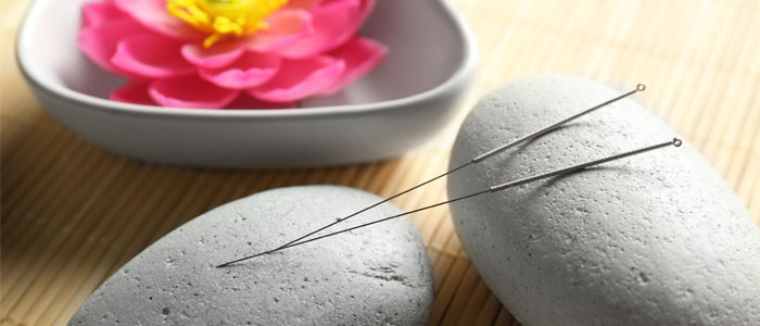 Acupuncture Destination Wellness Center