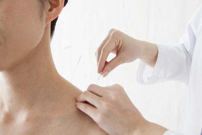 Acupuncture for Allergy Relief 